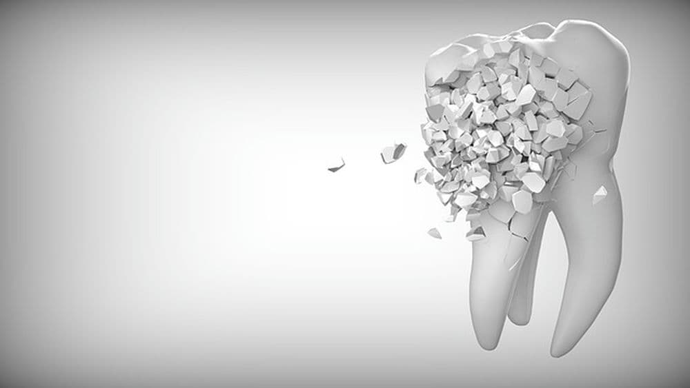 Kako se provodi preventivna skrb oko oralnog zdravlja preko usluga ortodontskih klinika?